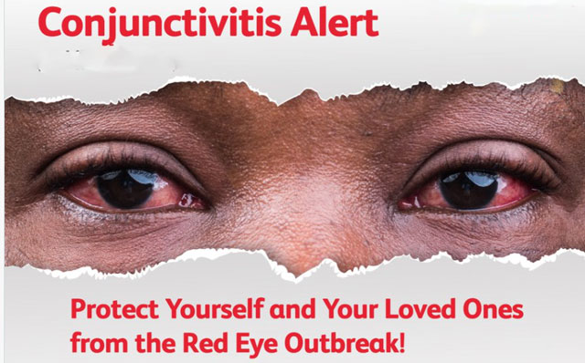 Outbreak Of Red Eye Disease Confirmed In Gulu City&nbsp;Schools