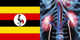 Ugandans decode kidney disease gene in&nbsp;Africans